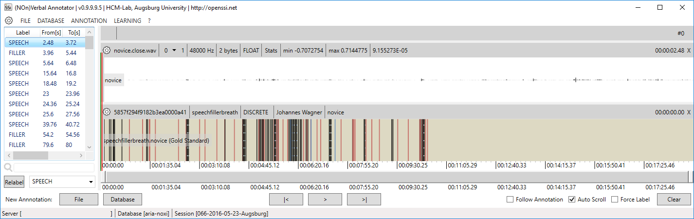 Session before completion.